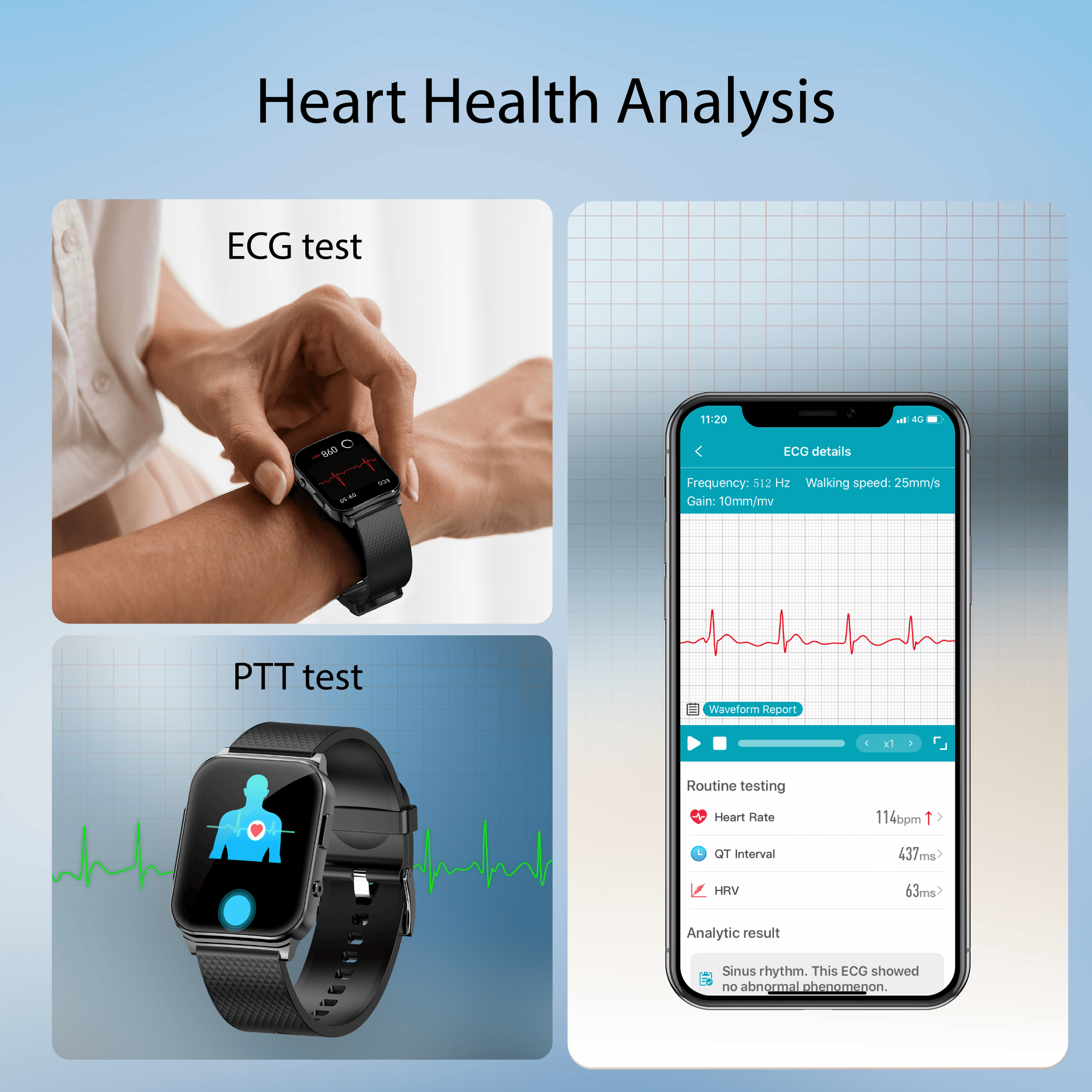 Suga03 PTT Dynamic ECG Blood Glucose Heart Rate Blood Pressure Monitoring Smart Watch
