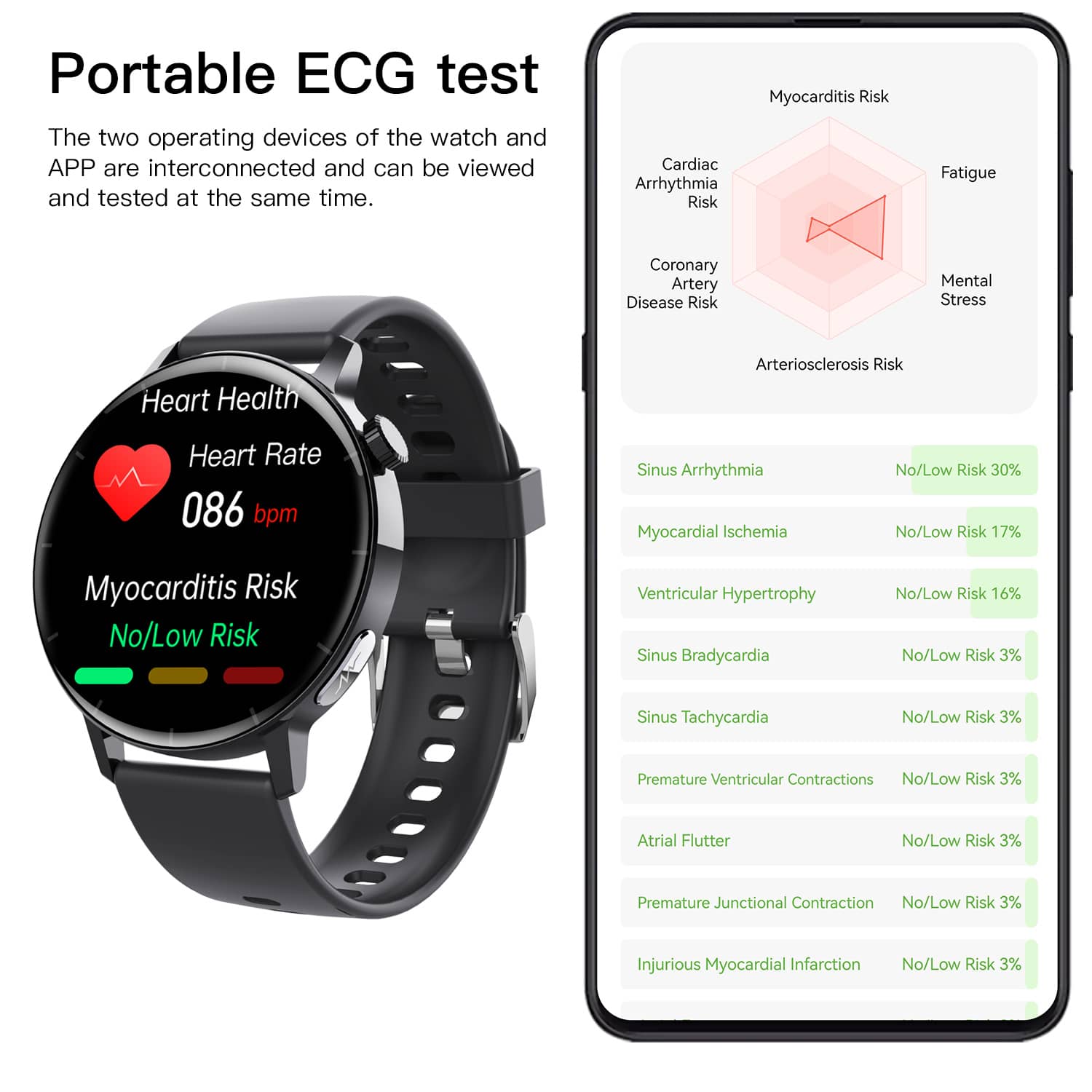 Suga67pro Fourth-generation Blood Sugar Blood Pressure ECG/EKG Smart Watch